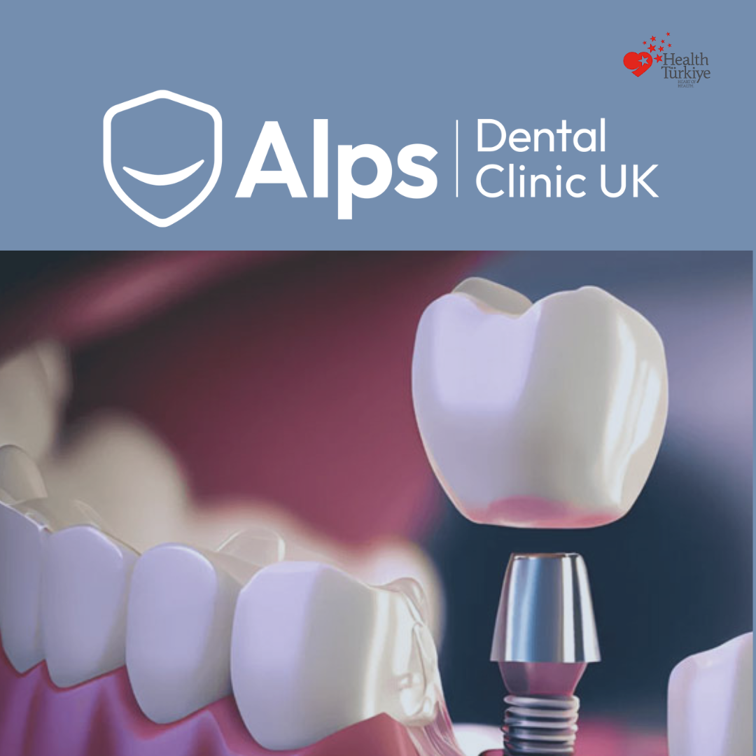 Dental implants in Turkey for UK patients using Straumann system at Alps Dental Clinic Antalya
